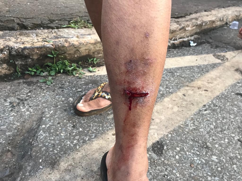 CDHM pede informações e providências ao governo mineiro sobre violência policial contra mulheres em Brumadinho 