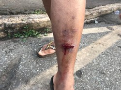 CDHM pede informações e providências ao governo mineiro sobre violência policial contra mulheres em Brumadinho 