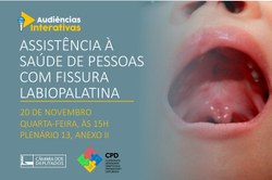 Audiência pública debaterá a Assistência à Saúde de Pessoas com Fissura Labiopalatina