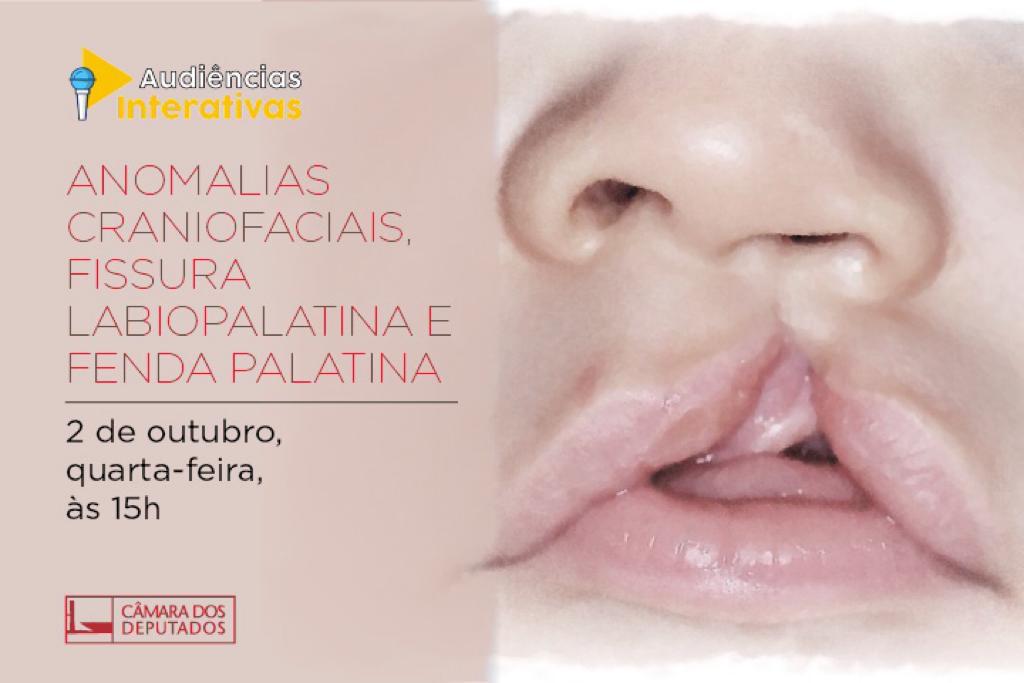 Seminário tratará das anomalias craniofaciais