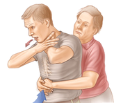 Seguridade aprova divulgação em restaurantes de procedimento para primeiros socorros   